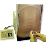 Epidural Injection 