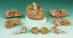 Brain, 8 part