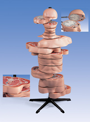 MRI Torso, 15 Transverse Sections