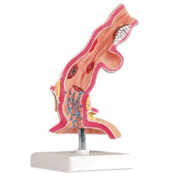Pathological Model of the Esophagus 